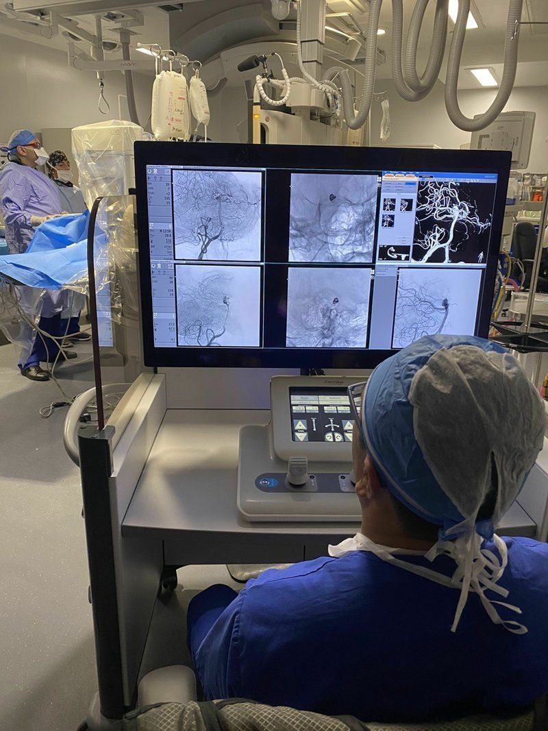 Surgeons successfully treat brain aneurysms using a robot – Neuroscience News